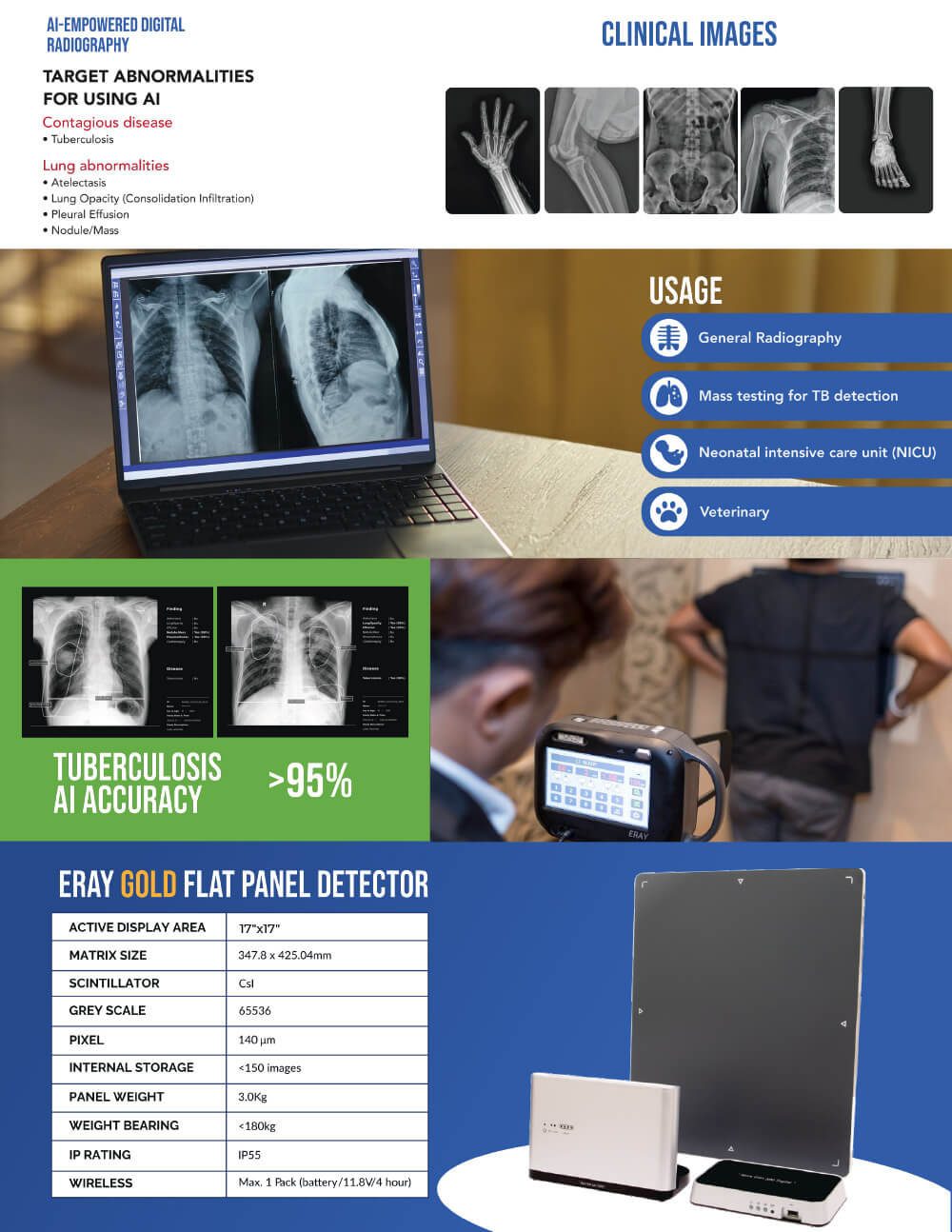 Handheld X-Ray Handheld X-Ray